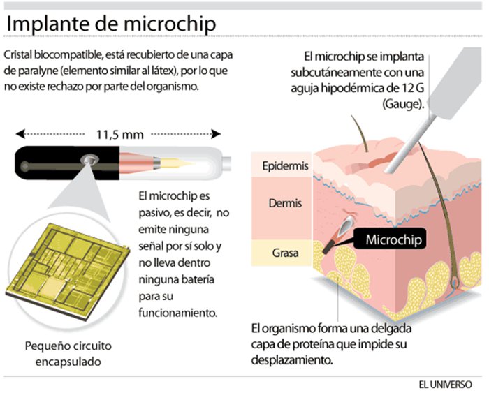 Microchip